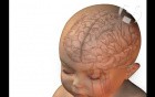 Fetal Circulation and Brain Oxygenation