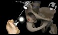 Future Total Hip Replacement Revision
