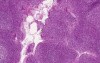 Palatine Tonsil - Histology