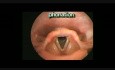 Laryngeal Movements
