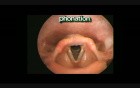 Laryngeal Movements
