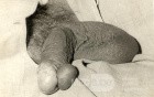 Penis