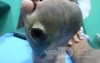 Diabetic Foot Ulcer - Neuropathic - Filled With Herbal Material