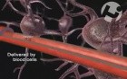 Effects of Cardiac Arrest on the Brain