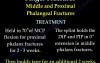 Metacarpal and Finger Fractures - Video Lecture