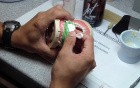 Anterior Bridge Preparation, Part 5 - Jet Provisional Fabrication - 1St Pass Before Reline