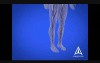 Diabetes Education - 3D Medical Animation