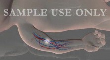 Brachial Pulse Location In An Infant