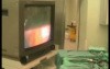 Laparoscopy