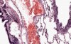 Lung - Histology