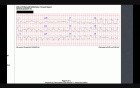 ECG Case 2