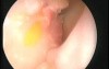 SIMONT ear, nose, throat and skull base simulator