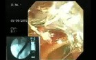 Larynx with Jaundice (6 of 6)