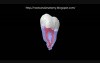 Mandibular Third Molar - 3