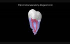 Mandibular Third Molar - 3