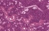 Submandibular Gland - Histology