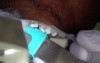CEREC #3 Intral Oral