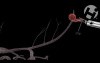 Correct Aneurysm Clipping