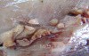 Early Gastric Cancer (13 of 21)