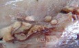 Early Gastric Cancer (13 of 21)