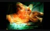 Uterine Artery Ligation During a C-Section