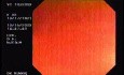 Tubulo - Villous Adenoma - Endoscopy (16 of 28)