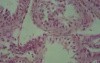 Transverse section of a seminiferous tubule