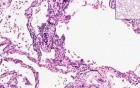 Metastatic calcification - Histopathology - Lung, kidney