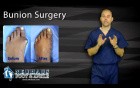 What to Expect with Bunion Surgery