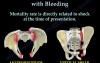 Pelvic Fractures With Bleeding 