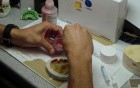 Moulaging An Implant Supported Denture Impression - Old School With Gi-Mask