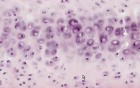 Hyaline Cartilage - Histology