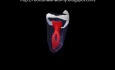 Mandibular Third Molar - 4