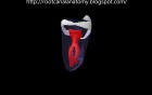 Mandibular Third Molar - 4