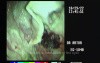 EUS cystogasrtostomy