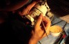 Diagnostic Waxup Part 5