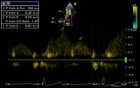 Pulmonary Vein Flow Normal