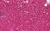 Cholestasis - Histopathology - Liver
