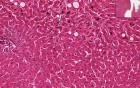 Cholestasis - Histopathology - Liver