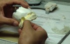 Guided Implant (Nobelguide) Part 8/10 - Esthetic Abutment Cerec