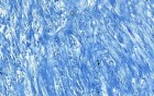 Fibro-Cartilage - Histology