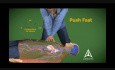 Cardiopulmonary Resuscitation - CPR - 3D Medical Animation