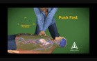 Cardiopulmonary Resuscitation - CPR - 3D Medical Animation