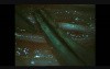 Microsurgery Tutorials. Lesson 16: Microneurorrhaphy With Venous Graft. Rat Saphenous Nerve and Vein