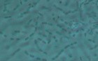 Woman - Urethra - Streptobacillus