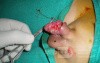 Penis Injury  Intra-Operative Photo