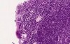 Pharyngeal Tonsil - Histology