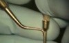 Perioscope Presentation