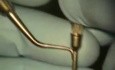 Perioscope Presentation