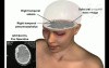 Skull And Brain Injuries